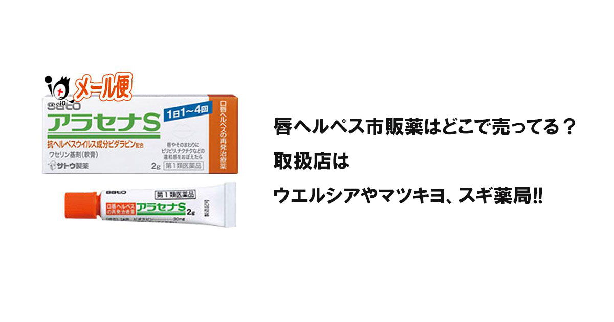 唇ヘルペス市販薬はどこで売ってる?取扱店はウエルシアやマツキヨ、スギ薬局!!